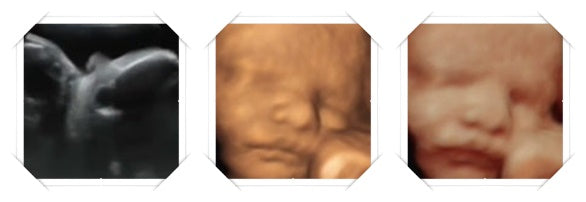 30 week ultrasound image scans 3D