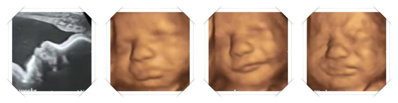 34.1 week ultrasound image scans 3D