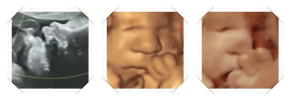 38 week ultrasound image scans 3D