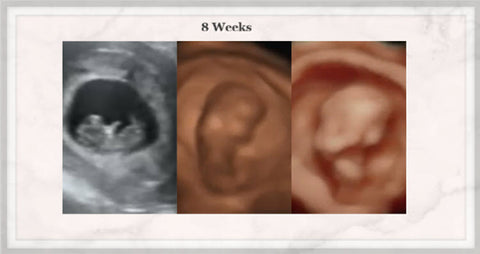 8 week baby ultrasound