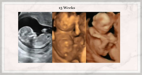 15 week baby ultrasound