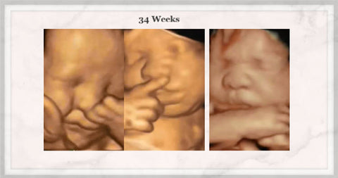 34 weeks 3d baby ultrasound picture