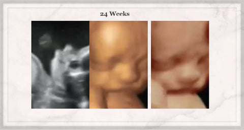 24 Week 3D baby pictures