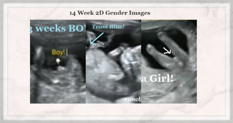 14 week baby gender pictures