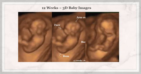 12 week baby ultrasound pictures