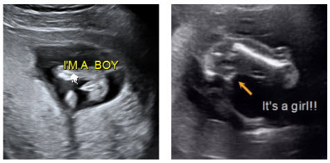 Baby Gender Reveal Baby Photo Album Sonogram Ultrasound Boy Girl