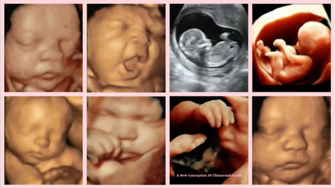 3D/4D/5D baby ultrasound pictures