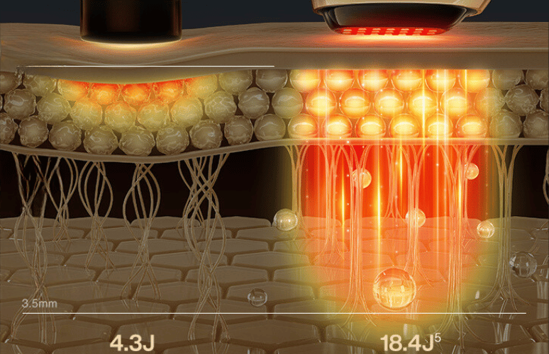 Picture of the S1 facial energy display