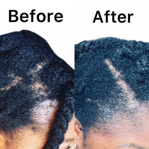 Hair Growth Oil Before and After