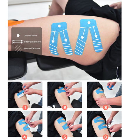 CKeep design for Runner's Knee Tape