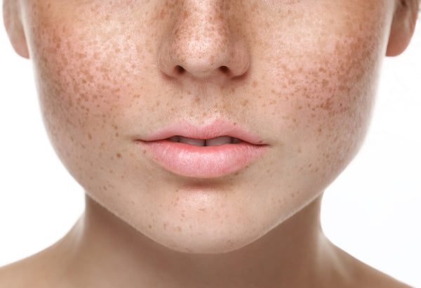 Your skin and lips may suffer from dryness when the weather changes