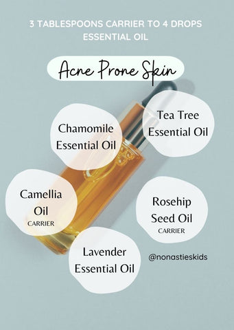 best oils to use for acne prone skin