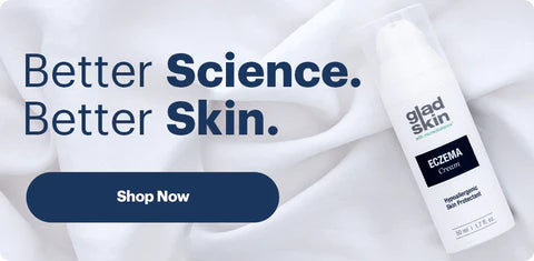 Gladskin Eczema Cream pictured next to text reading 'better science, better skin.' There is a shop now button. 