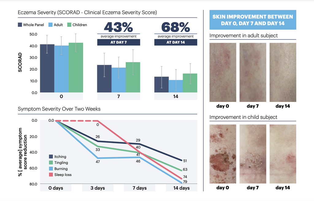 Eczema Severity (SCORAD - Clinical Eczema Severity Score) Graph: 43% average improvement at day 7. 68% average improvement at day 14. Symptoms chart: itching, burning, tingling, and sleep loss all dissipated over 14 days. Skin improvement chart: skin images of adult and child subjects at day 0, day 7, and day 14 show dramatic decrease in appearance.