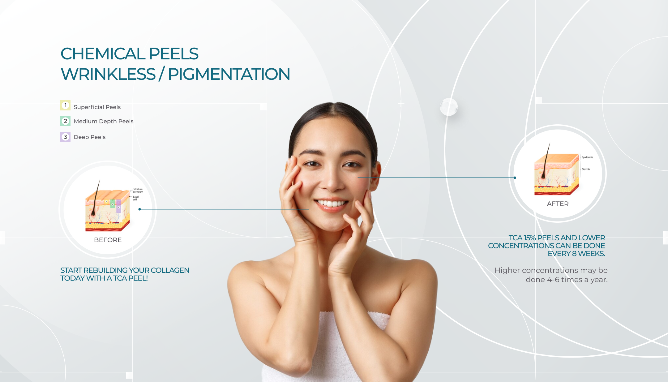 chemical-peels