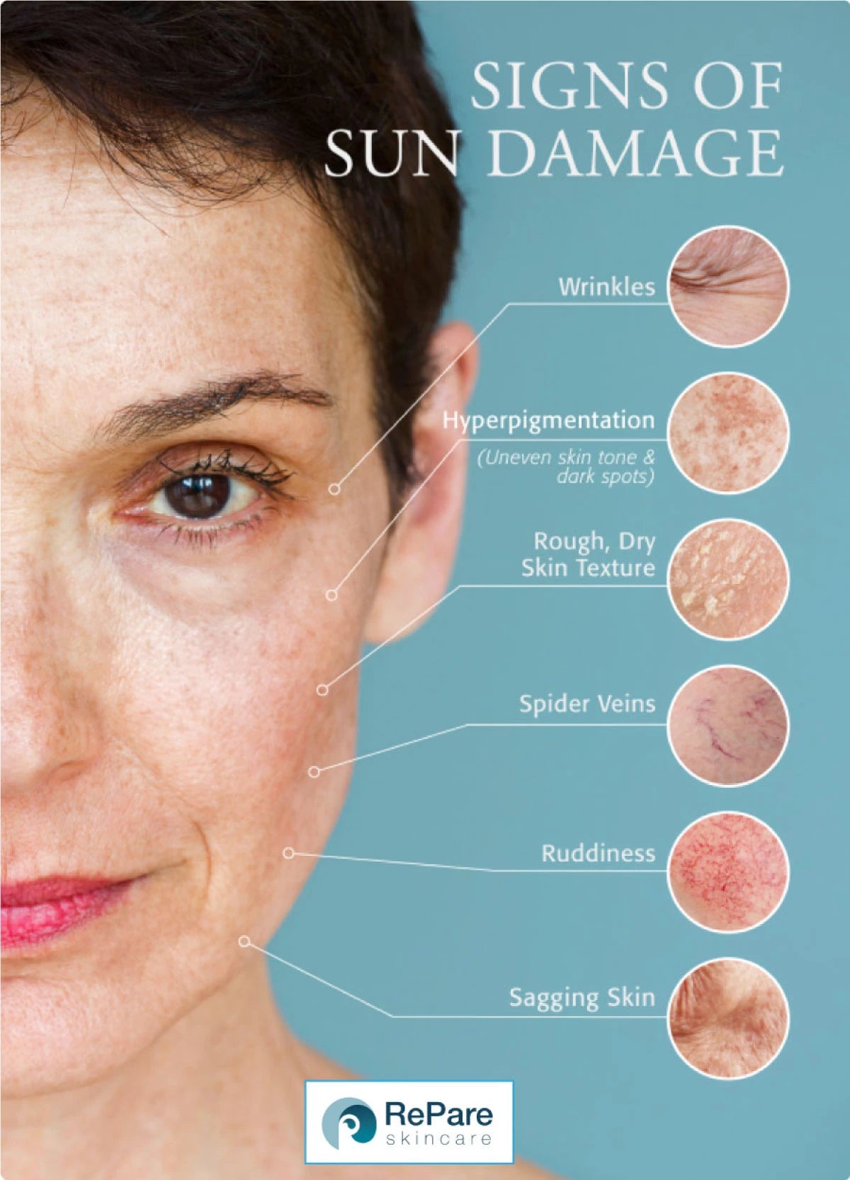 signs-of-aging-skin_r