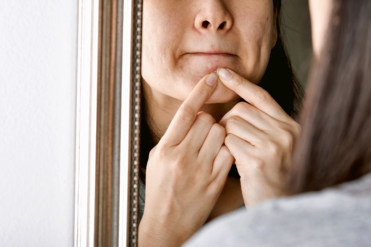 Woman with Skin Condition