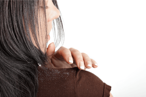 How to get rid of dandruff