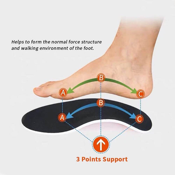 Explained: How Arch Support Foot Insoles Work