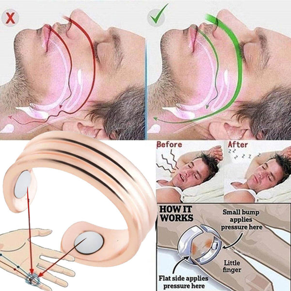 Therapeutischer Magnetring zur Lymphdrainage. Kaufen Sie Akupunktur auf Mounteen. Weltweiter Versand möglich.