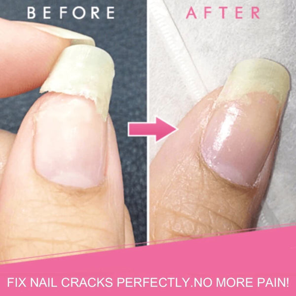 Instant Nail Repair Gel - Before/After