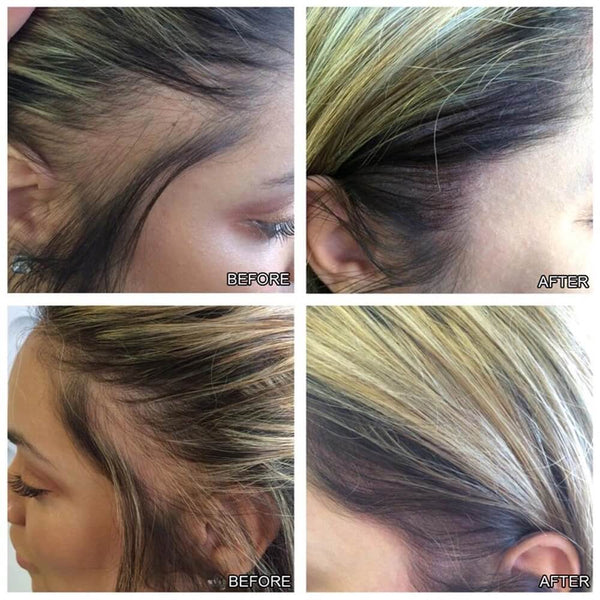 Sérum roll-on intense pour la croissance des cheveux - Avant et après