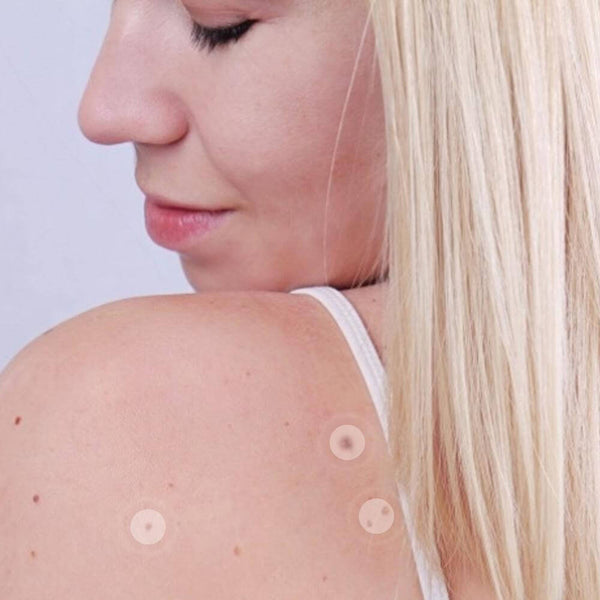 Skin Mole Removal Patch. Shop Acne Treatments & Kits on Mounteen. Worldwide shipping available.