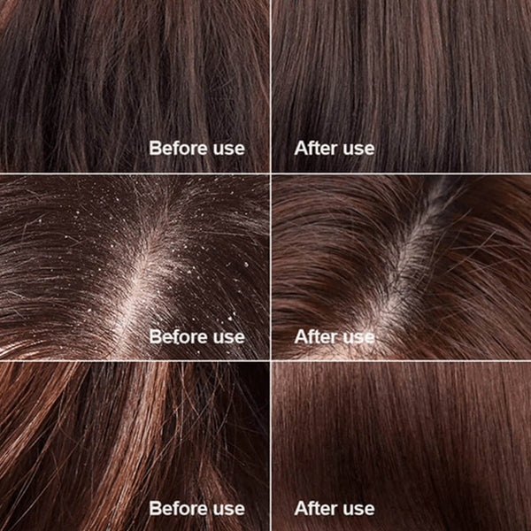 Centella Scrub for Hair Growth - How it works