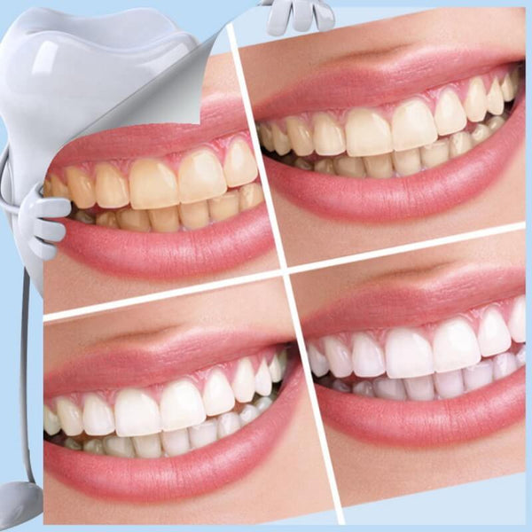 Pro Nano Teeth Whitening Kit - Buy online