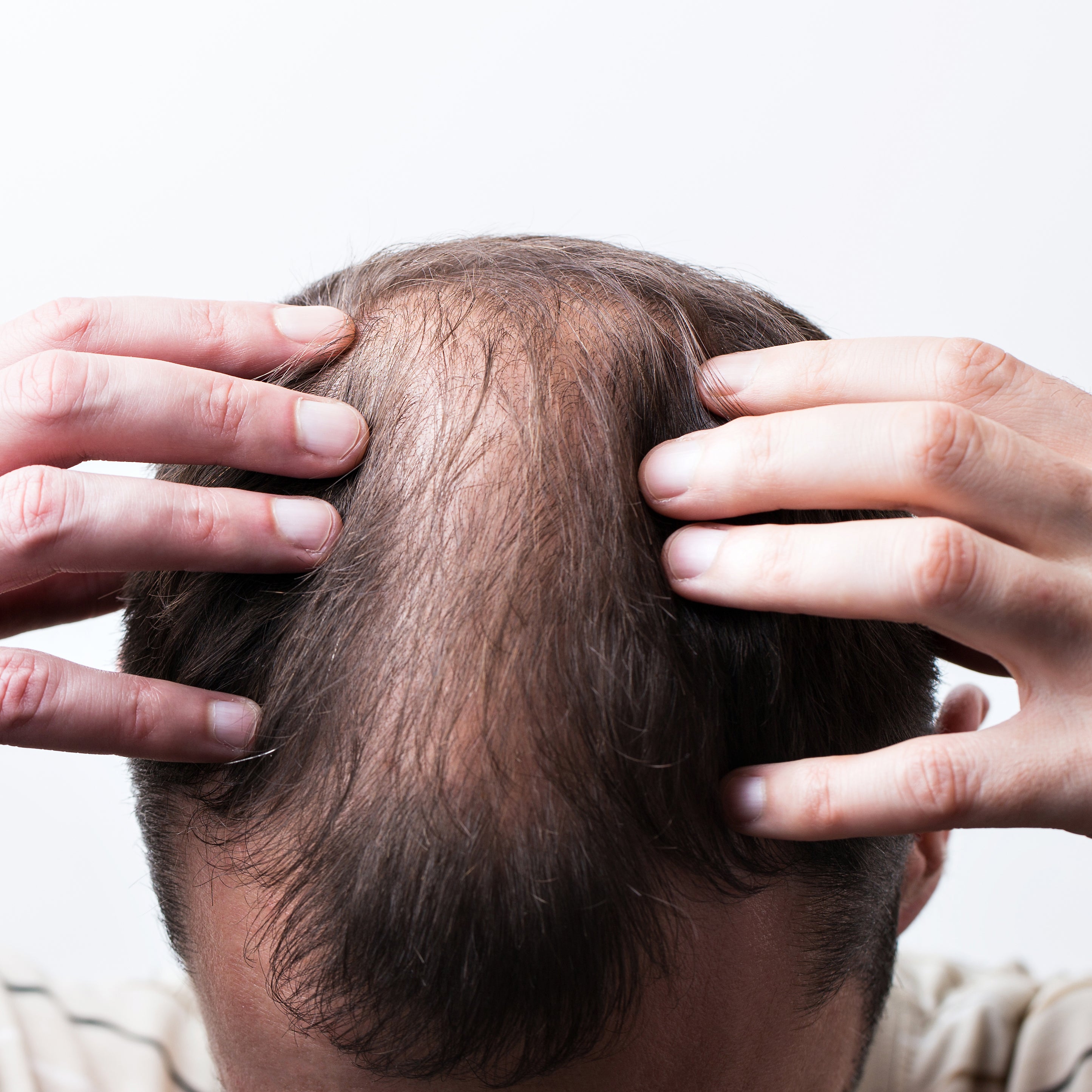 How to regrow hair naturally for men? - Juicy Chemistry