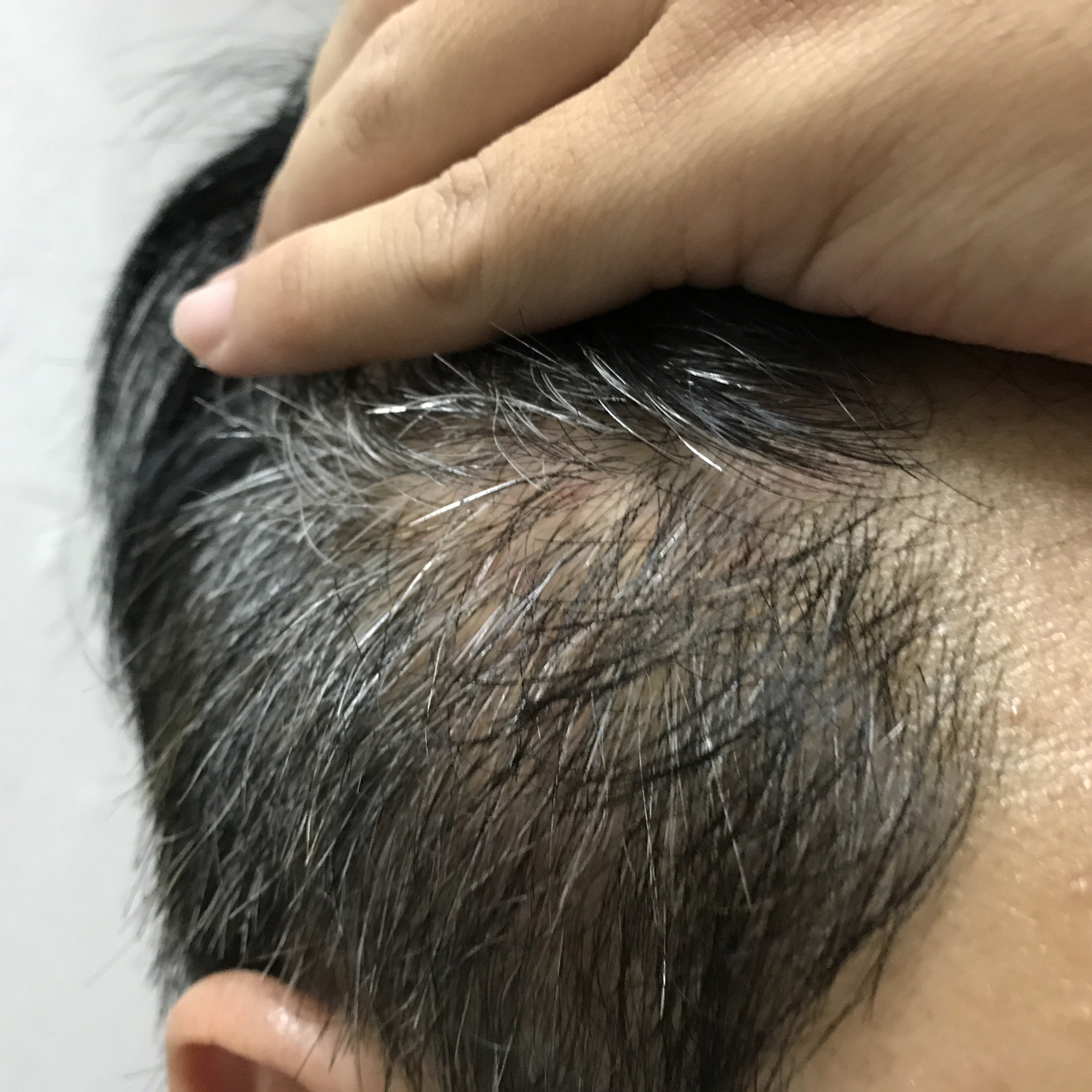 Can Gray Hair Be Reversed Causes and Treatment  GoodRx
