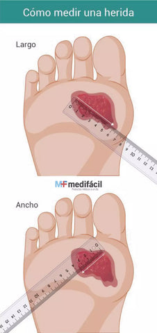 Indicaciones sobre cómo medir un herida a lo largo y a lo ancho - Medifácil
