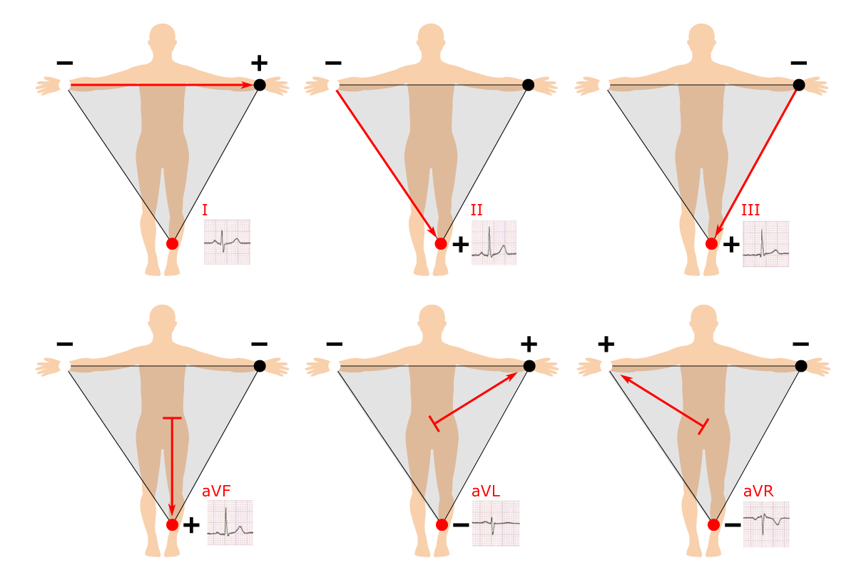 Ecg Electrode Placement Chart