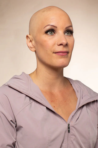 Woman without a wig bald