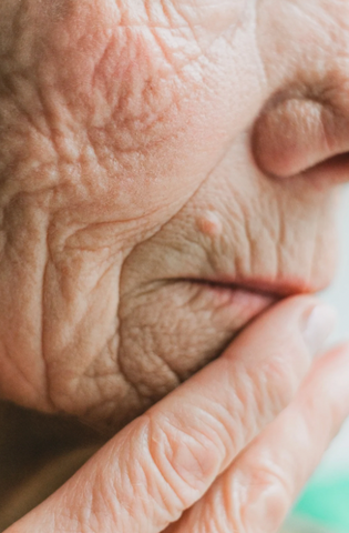 elderly woman with wrinkles on skin regeneration