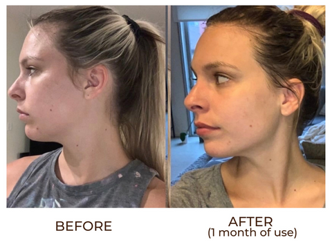 Megan Tries It: A Gua Sha Facial for Breakouts