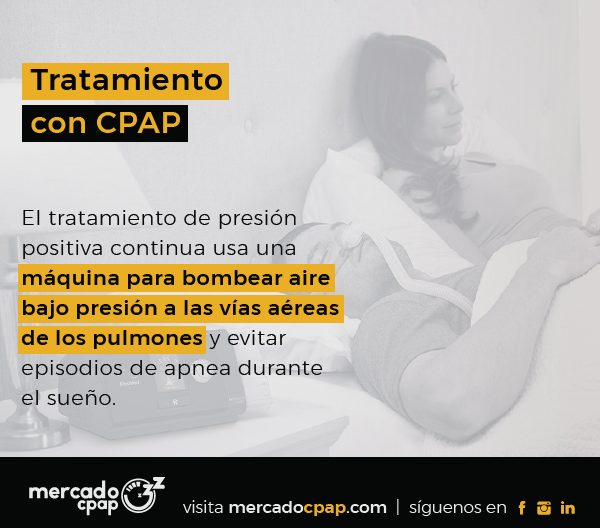 Tratamiento con CPAP