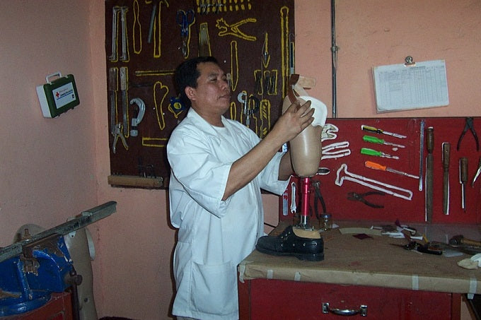 Inspecting Prosthetic