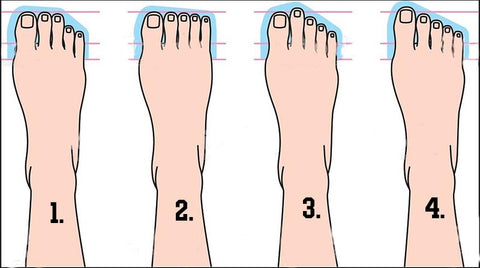 Foot Shape