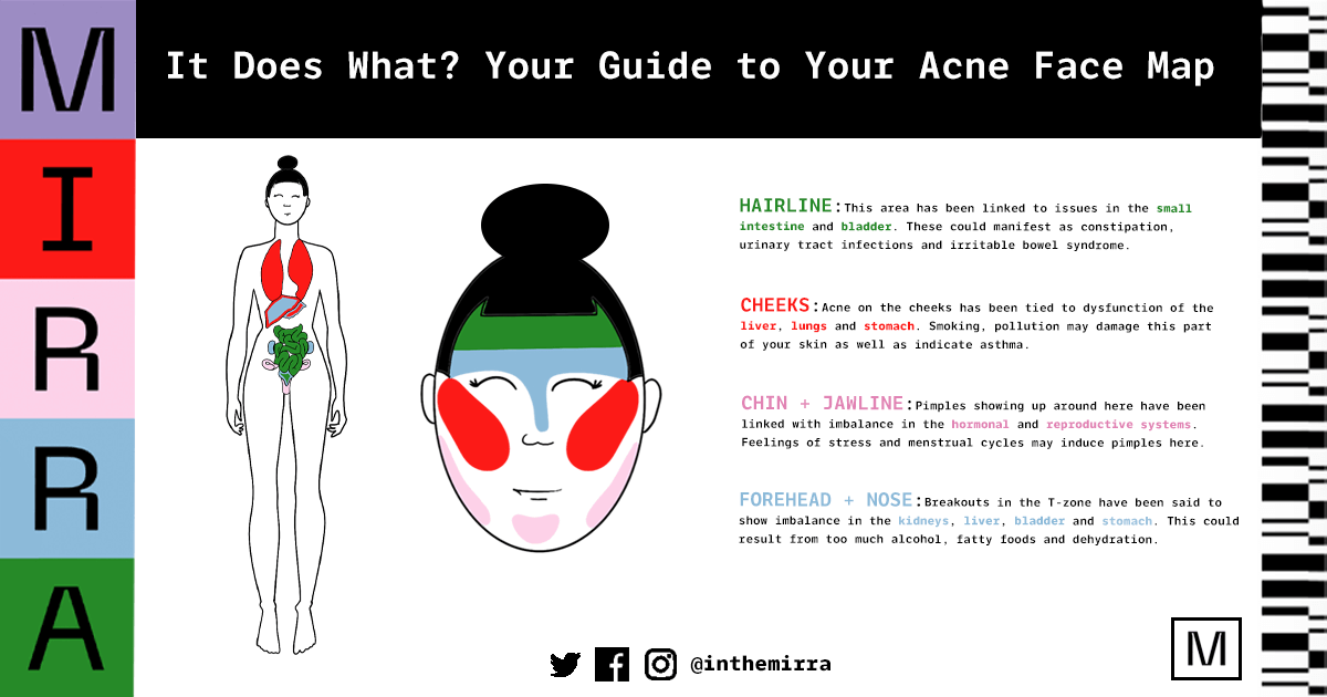 Guide to Acne Face Map, how to make your acne face map and how to read acne face mapping