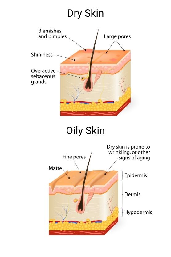 Diagram comparing dry skin and oil skin