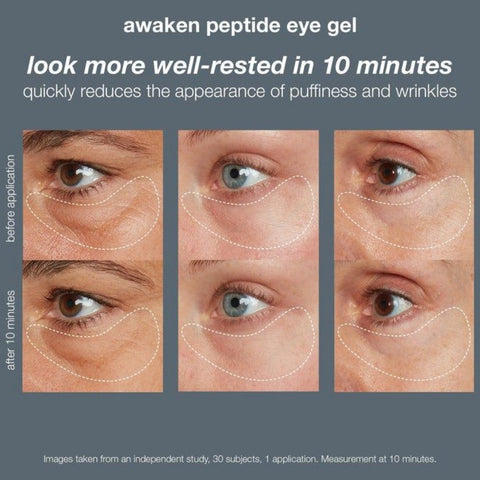 how to get rid of puffy and swollen eyes – Dermalogica Australia