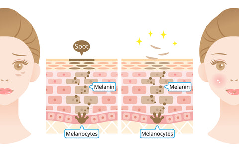 Illustration of Melanin in Skin