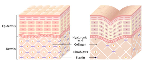 illustration of young skin compared to older skin