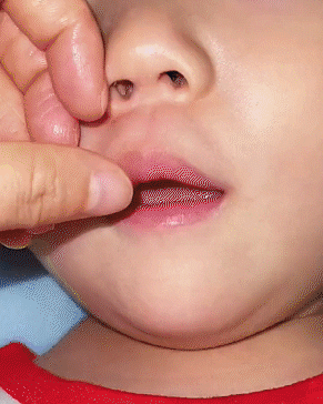 Escova de dentes infantil