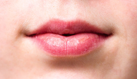 Woman with dry lips, for AutoBrush