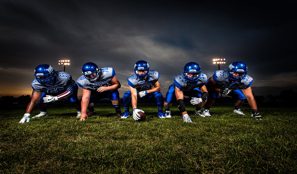 mouthguard