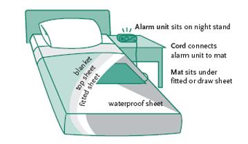 Pad-type Alarms Diagram