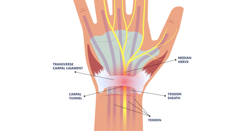 carpal tunnel median nerve