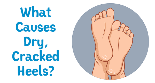 What Causes Dry Cracked Heels?